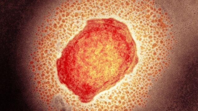 猴痘病毒(photo:BBC)