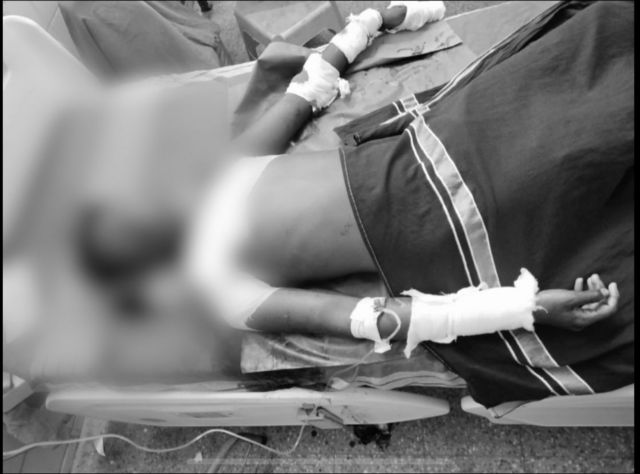 அரிவாள் வெட்டுக்கு பாதிக்கப்பட்ட மாணவர்