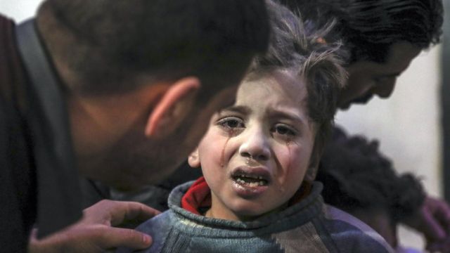 An injured child is treated at a hospital in the rebel-held Eastern Ghouta, Syria (19 February 2018)