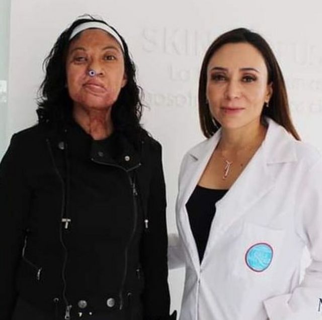 Esmeralda Millán con Isela Mendez, la cirujana que la ayudó con sus operaciones.