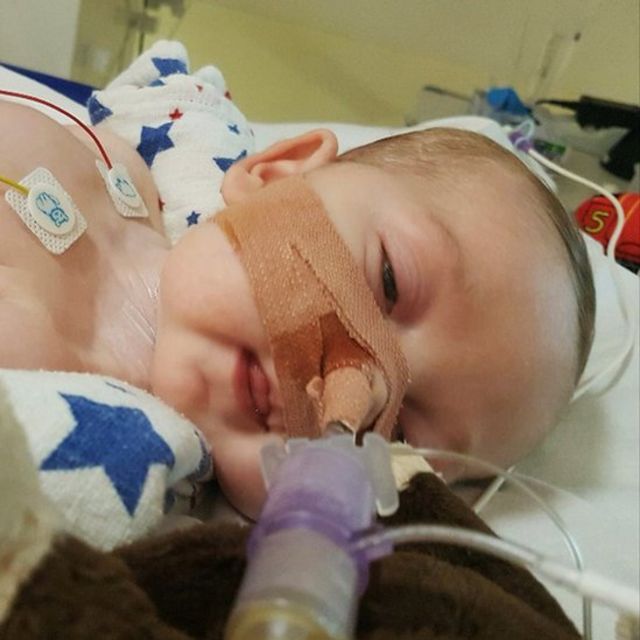 Charlie Gard entubado con los ojos abiertos.