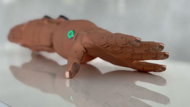Біонічний протез руки Truelimb друкуються на 3D принтері.