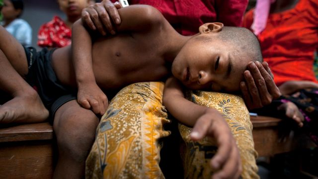 Niño con malaria recostado con la cabeza en la falda de su madre