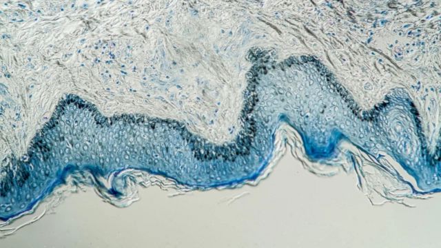 Kusta: Penyakit kuno misterius yang belum bisa dipecahkan para ilmuwan