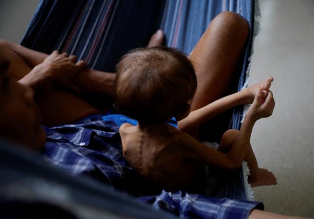 Criança yanomami de 4 anos sentada em rede com o pai é atendida no hospital infantil Santo Antonio em Boa Vista, Roraima, 27 de janeiro de 2023