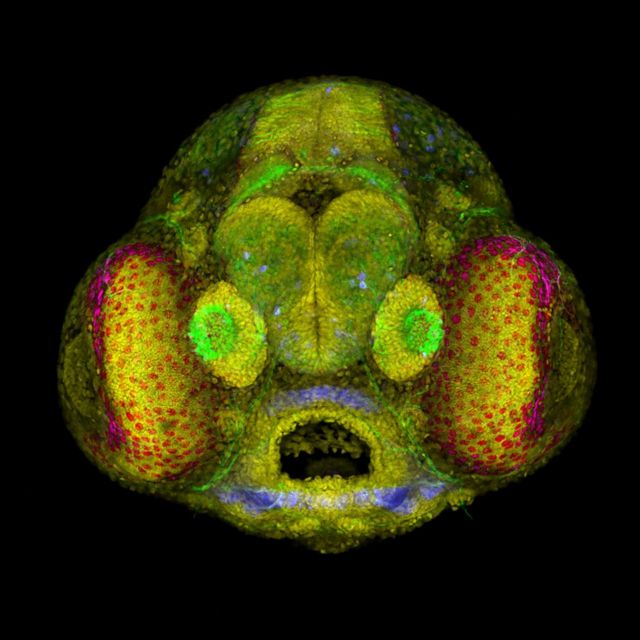 Foto microscópica de un embrión de pez cebra.