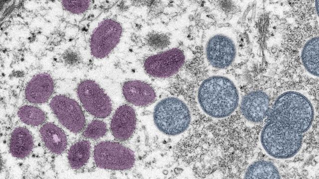 L'image montre des particules de virus monkeypox