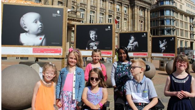 Retratos e histórias de crianças com doenças raras atendidadas por hospital em Birmingham, na Inglaterra, são exibidas em exposição