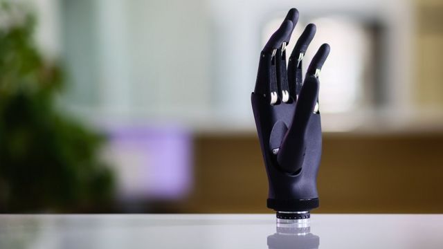 Це біонічна рука компанії Esper Bionics
