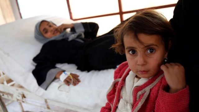 Yemen'de iki milyon kadar çocuk akut yetersiz beslenmeyle karşı karşıya.