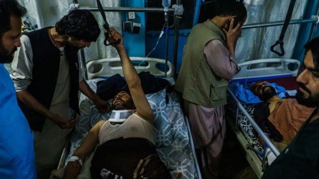 काबुल धमाके में घायल हुए लोग