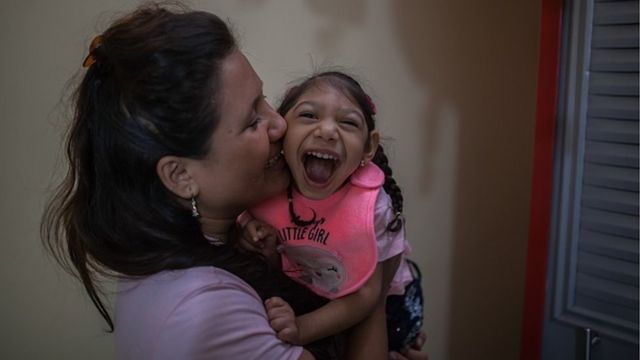 Una niña colombiana con microcefalia por el virus zika.