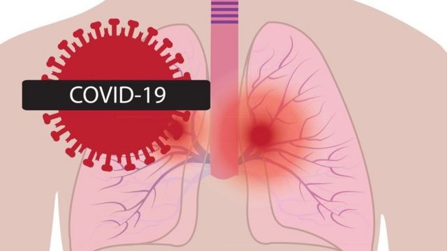 கொரோனா: குணமடைந்த பின்னும் நுரையீரல் பாதிப்பு - ஆய்வில் அதிர்ச்சி
