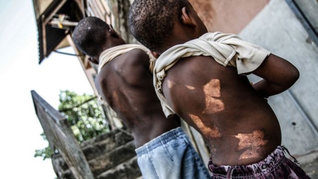 Estigmatizados Y Golpeados Los Niños Acusados De Brujería Y Asesinato En Nigeria Bbc News Mundo 7230