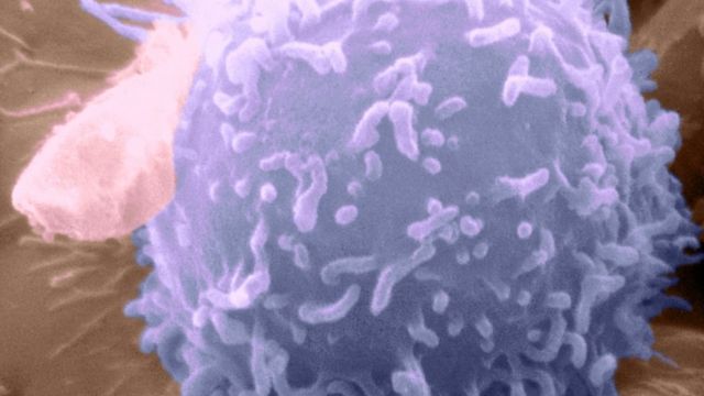 记忆B细胞：能给你超级免疫力的细胞(photo:BBC)