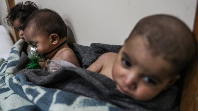 أطفال مصابون في الغوطة الشرقية