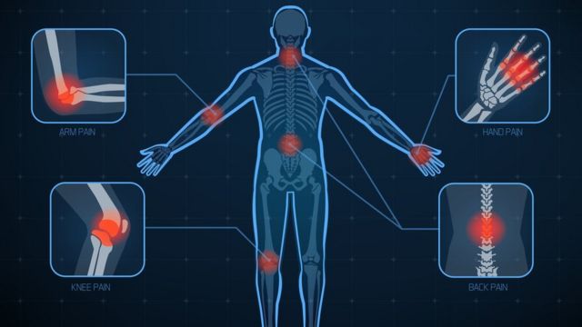 La humedad es la que causa dolor en las articulaciones, según un estudio - BBC News Mundo