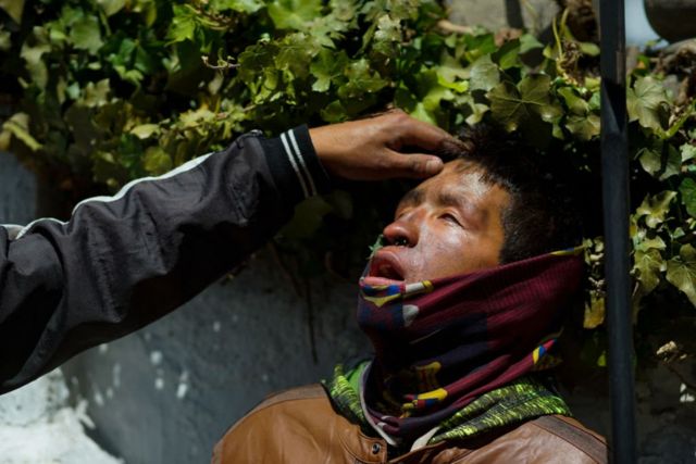 El rostro de un manifestante herido en el noveno día de protestas en Ecuador.