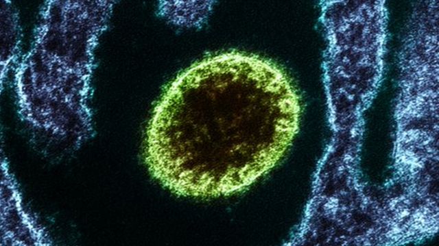 فيروس نيبا (باللون الأخضر) تحت المجهر