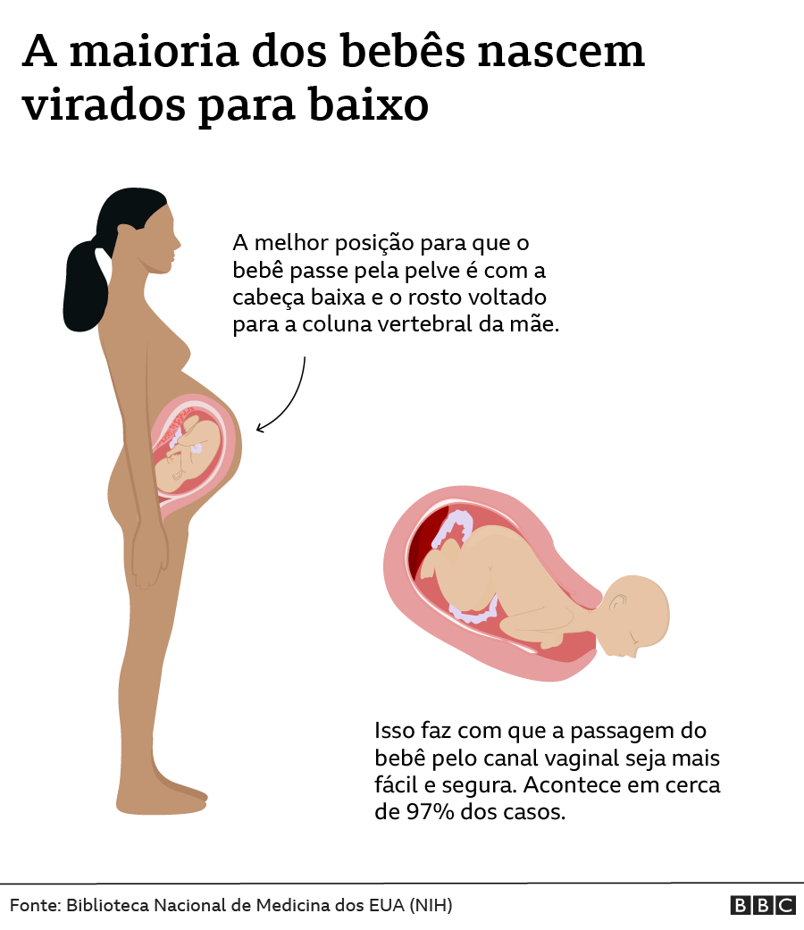 Gráfico sobre a posição do nascimento do bebê