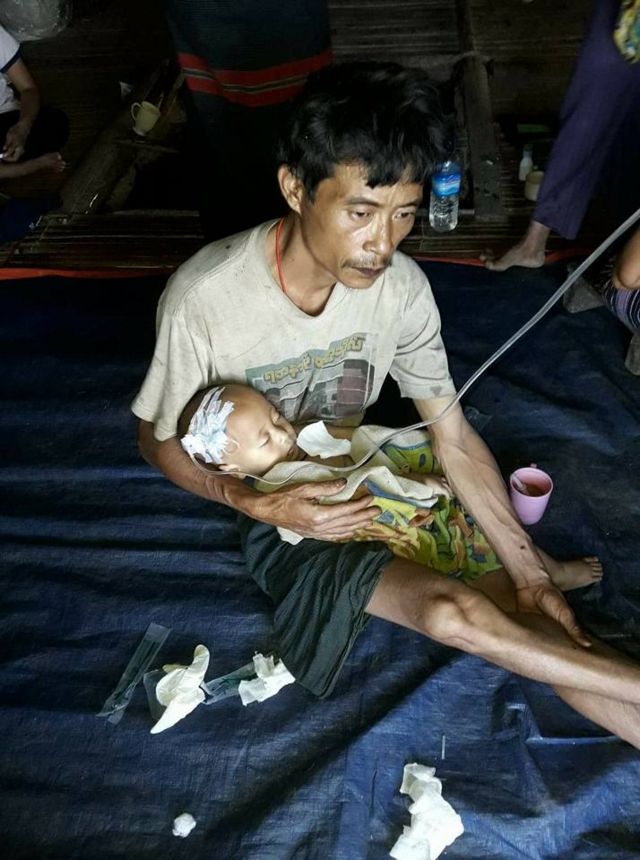 လန်ပန်းကျေးရွာက ရောဂါဖြစ်နေတဲ့ ကလေးငယ်