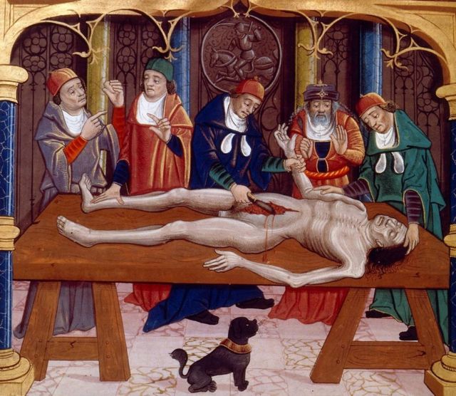 Medieval illustration of an autopsy performed in the Middle Ages.  From the French manuscript 