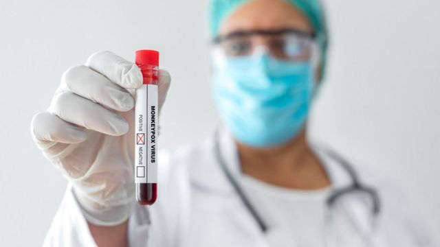 குரங்கு அம்மை வைரஸ்