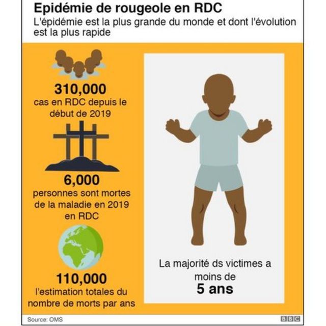 La rougeole en RDC