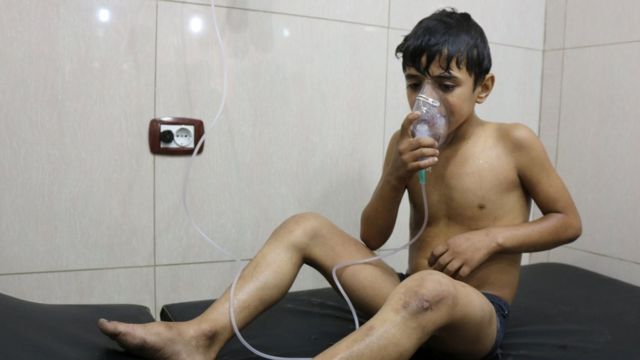 シリア・アレッポで塩素ガス攻撃を受けたとされる少年（6日）