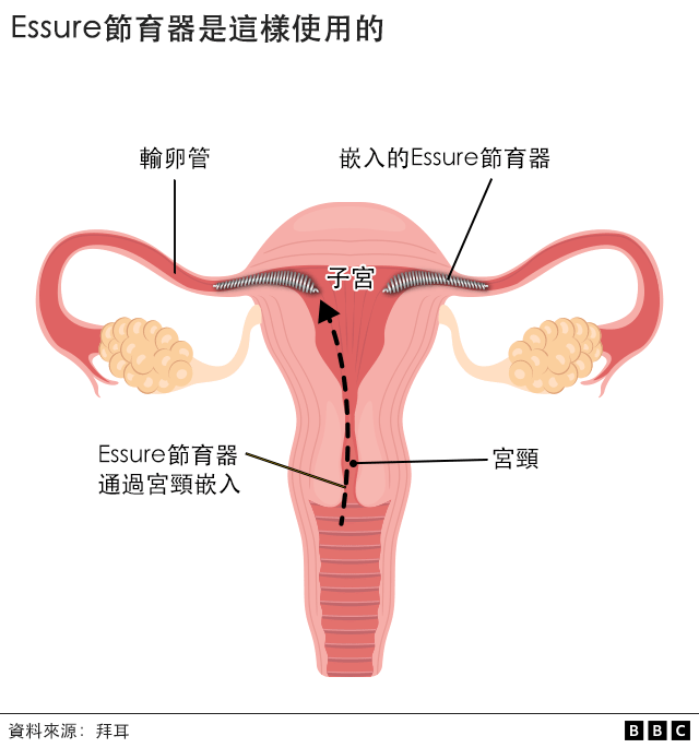 图示