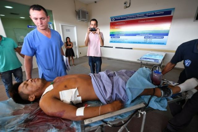 Un paciente herido en Brasil