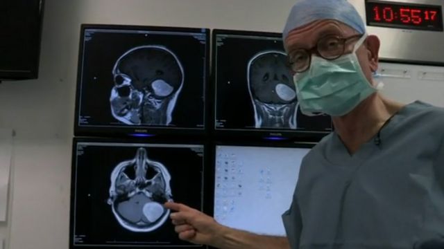 Henry Marsh mostrando el escáner de un tumor cerebral "probablemente benigno".