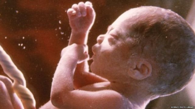 भारत में बच्चों की मृत्यु दर घटी, पर ये कैसे संभव हुआ - BBC News हिंदी