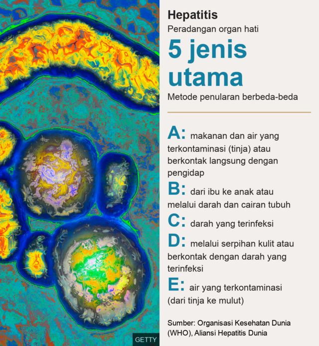 Hari Hepatitis Sedunia: Perjuangan Pasien Hepatitis B Melawan Stigma ...