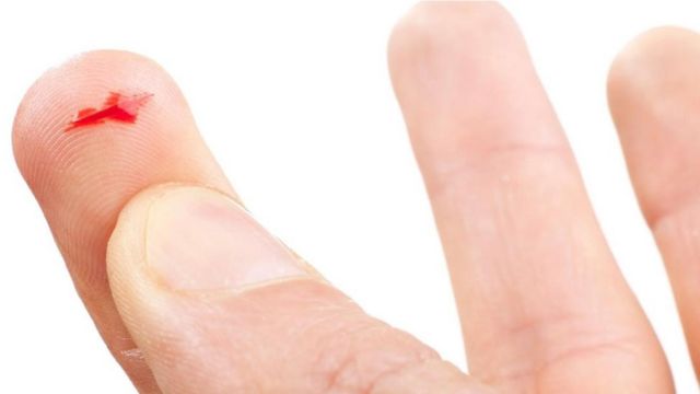 Una persona con una herida provocada por un papel en el dedo