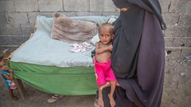 Niño y madre en Yemen