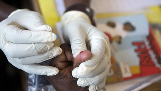 Le nouvel essai clinique représente un espoir dans la recherche d'un vaccin préventif contre le sida.
