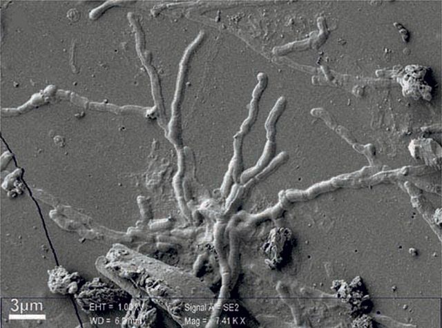 Imagen de tomografía de neuronas y los axones del cerebro.
