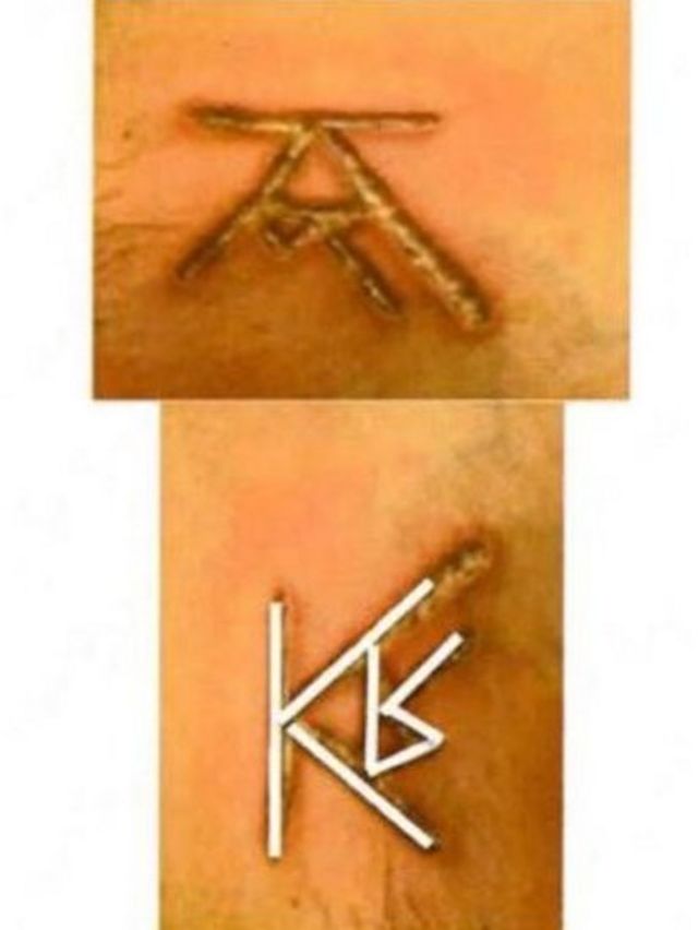 Marcas en el cuerpo