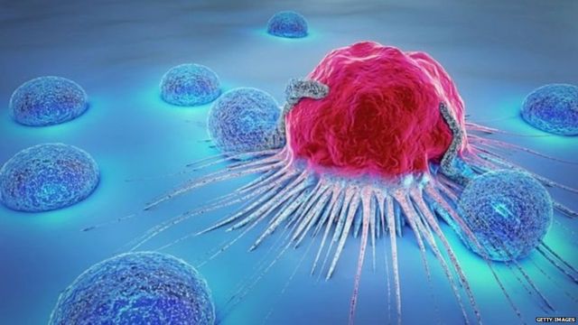 कैंसर के इलाज को आसान बनाने में मिली बड़ी सफलता - BBC News हिंदी