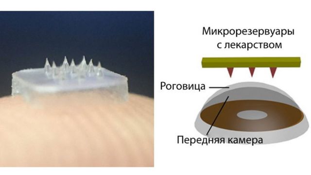 Схема применения