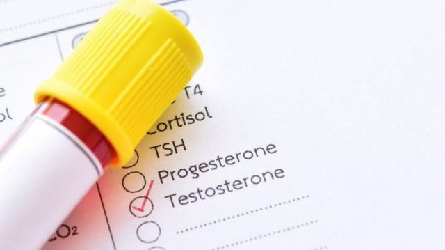 Fiche d'analyse de testostérone