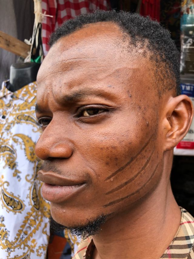 A man with a scar on his face
