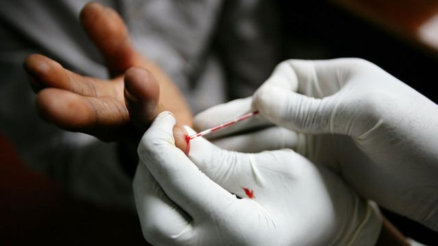 O que torna a popula&ccedil;&atilde;o negra mais vulner&aacute;vel ao HIV e a morrer por  complica&ccedil;&otilde;es da Aids - BBC News Brasil