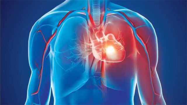 বিশ্বে ট্রান্সফ্যাট গ্রহণের কারণে হৃদরোগে আক্রান্ত হয়ে মৃত্যুর প্রায় দুই তৃতীয়াংশই হয় বাংলাদেশ সহ পনেরটি দেশে