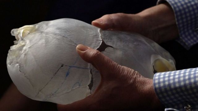 Modelo 3D dos crânios de Safa e Marwa