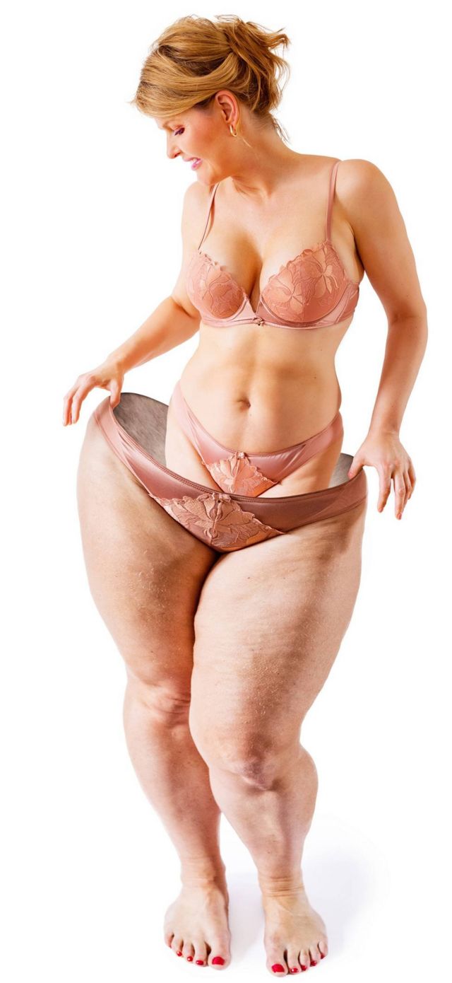Mujer delgada metida en su figura gorda