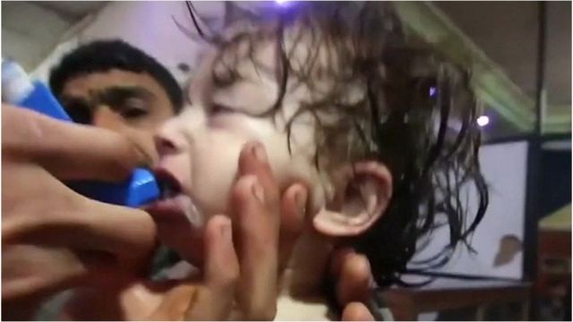 Ребенку оказывают первую медпомощь после предполагаемой химической атаки в городе Дума