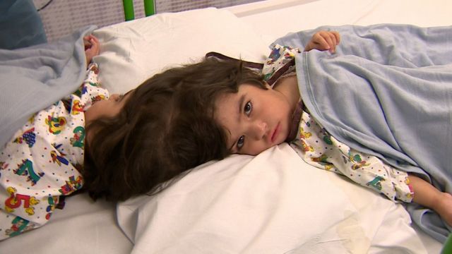 Safa e Marwa no hospital em Londres