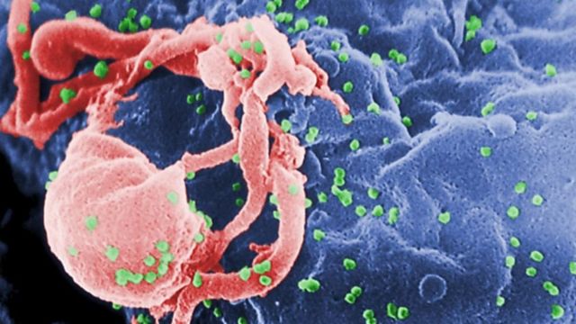 ایدز در درجه اول بیماری لنفوسیت تی (سلول‌های دستگاه ایمنی بدن) است که بطور مرتب توسط ویروس اچ آی وی در بیماران مبتلا از بین می‌رود